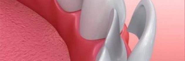 Treatments Offered by a Cosmetic Dentist in Upatoi, GA