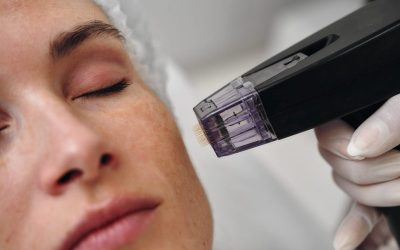 The Secret Behind The Science of Youthful Skin: Redefine Confidence with Precision and Skin Solutions like Botox in Westminster, CO.