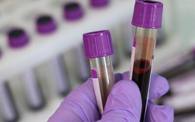 How On Site Drug and Alcohol Testing Enhances Workplace Safety