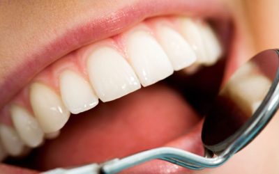 Transform Your Smile with Centreville Cosmetic Dentistry: A Guide to Perfect Teeth